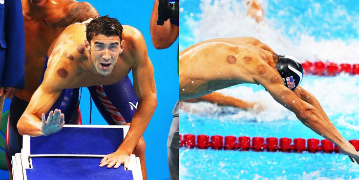 cupping michael phelps
